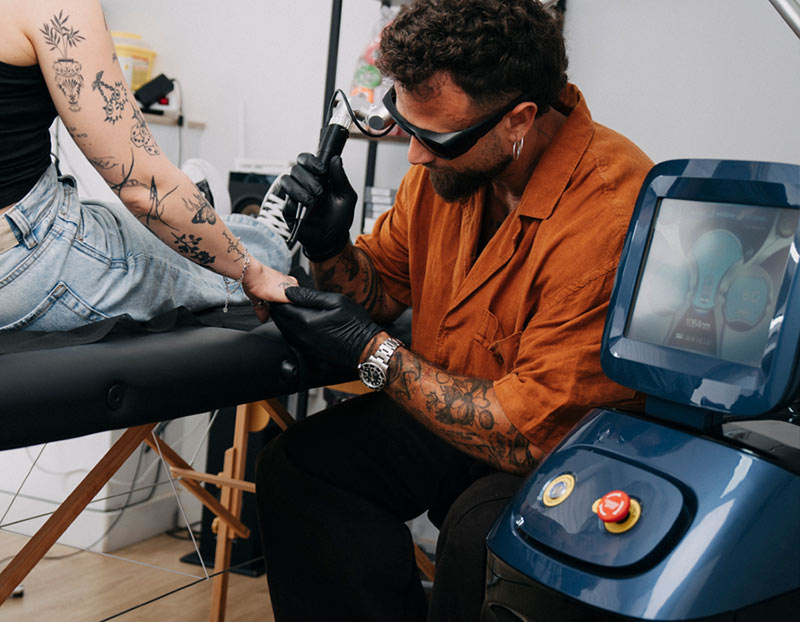Eliminación láser de tatuajes: cuándo valorar este tratamiento